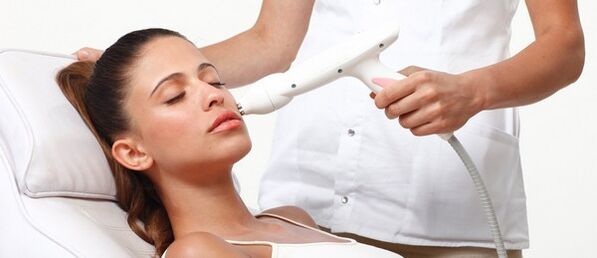 Laser rejuvenation process