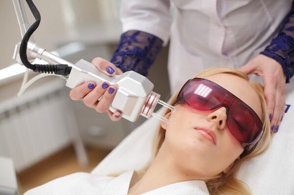 Laser rejuvenation