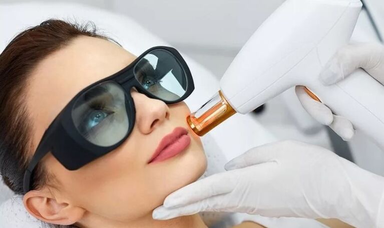 Rejuvenation with skin laser