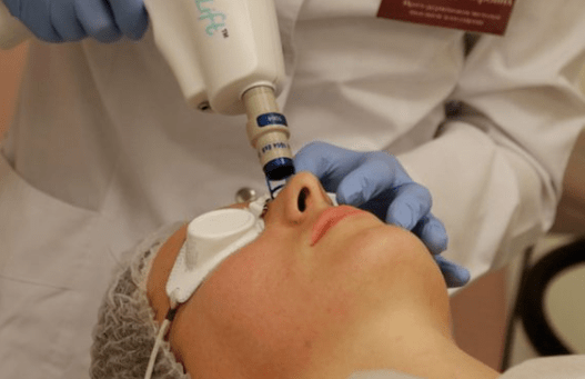 Non -refreshing laser renewal