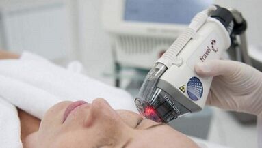 How is fractional skin renewal done