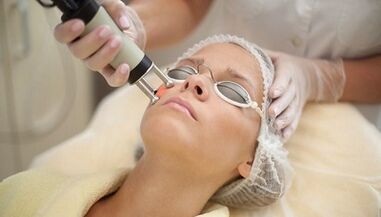 types of fractional facial skin renewal